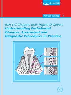 cover image of Understanding Periodontal Diseases